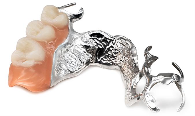 Delne proteze s printanimi kovinskimi zaponami