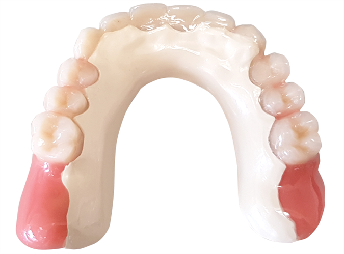 PEEK delna proteza brez kovinske osnove