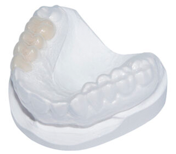 Nadomestni zob v foliji