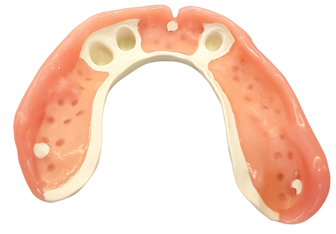 Delne proteze s teleskopi in konusi 