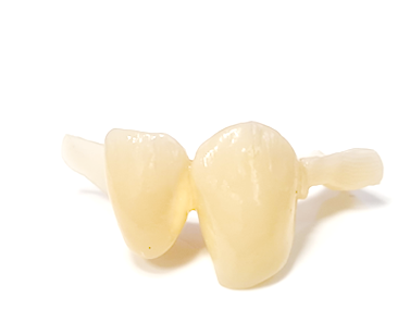 Estetska fiksna protetika